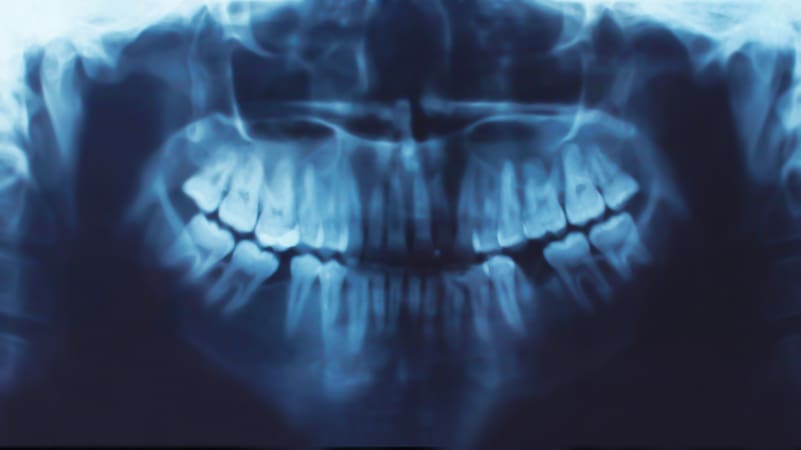 Unique Dental of Worcester offers Digital Xrays