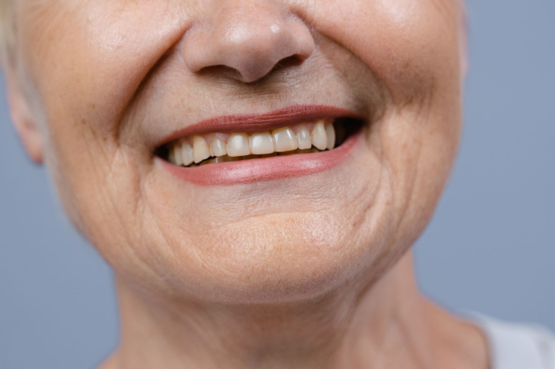 Cosmetic dentistry refreshing an aging smile