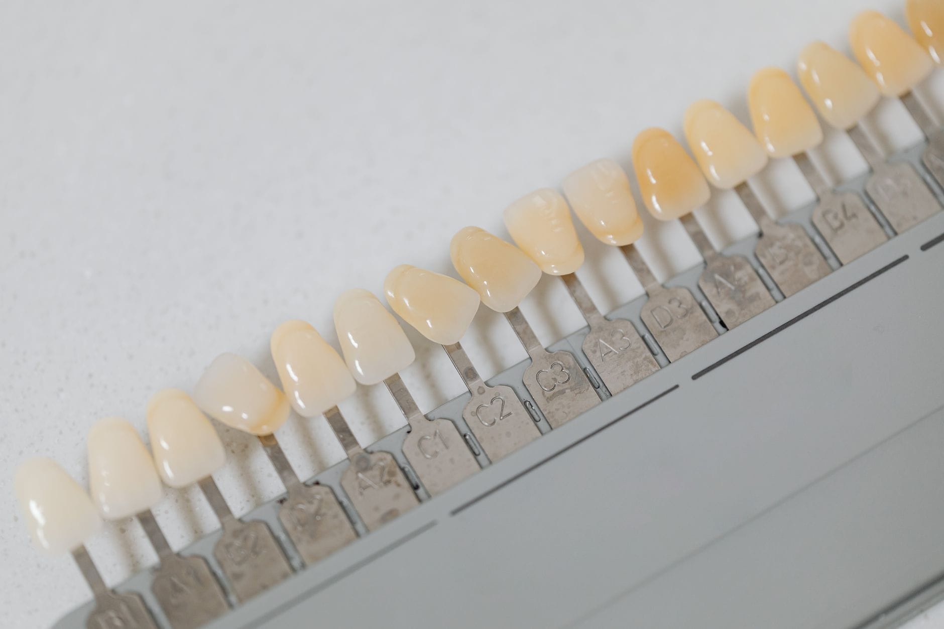 How to prepare for cosmetic dental treatment